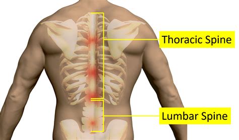 What Causes Pain Around the Ribs and Back Symptoms? - Regenexx