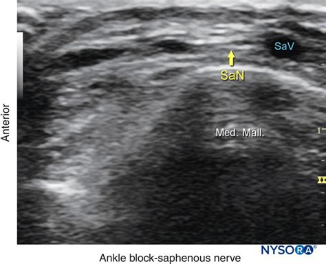 regional-anesthesia-us-anatomy-of-the-saphenous-nerve - NYSORA