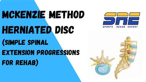 McKenzie Method and Herniated Discs | Spinal Extension Progressions - YouTube