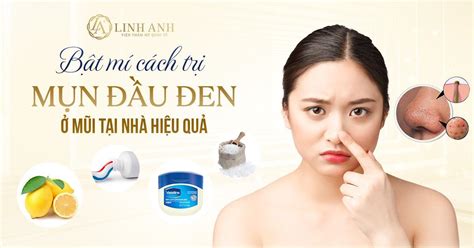 11 Cách trị mụn đầu đen ở mũi tại nhà đơn giản, CỰC HIỆU QUẢ - Cosy