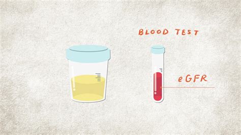 Knowing your kidney numbers and understanding the CKD Heat Map are ...