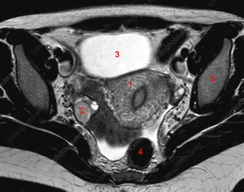 Normal female pelvis, MRI - Stock Image - C026/9012 - Science Photo Library