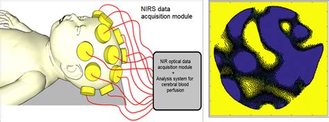 (Left) Diagram of neonatal NIR spectroscopy (NIRS) imaging. A series of ...