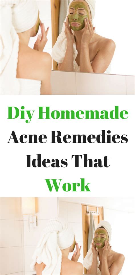 Diy Homemade Acne Remedies Ideas That Work - SimplyBeautyTips.Info | Acne remedies, Acne ...