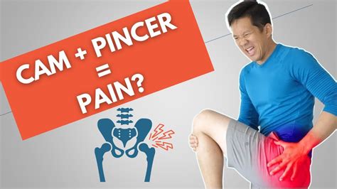 Cam and Pincer Impingement and Hip Pain - YouTube