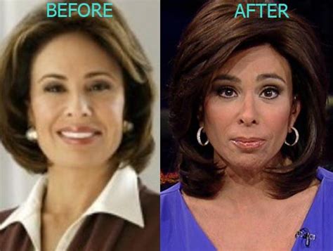 Jeanine Pirro Plastic Surgery Before And After Photos - CelebLens.Com