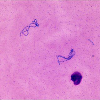 Case-wise isolated Kocuria species and antibiotic susceptibility | Download Table