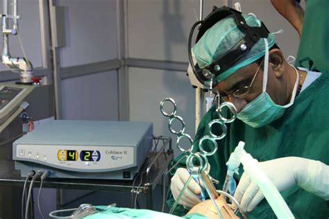 Surgery for Snoring-Coblator Surgery in Jubilee Hospital, Trivandrum ...