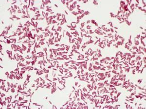 Biochemical Test of Escherichia coli (E. coli)