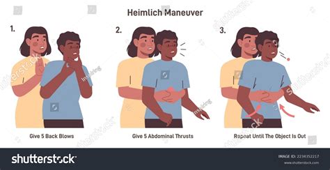 Choking First Aid Adult Heimlich Maneuver: Vector có sẵn (miễn phí bản ...