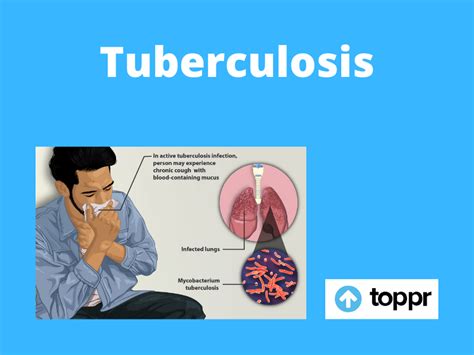 What is Tuberculosis: Tuberculosis Symptoms, Precautions