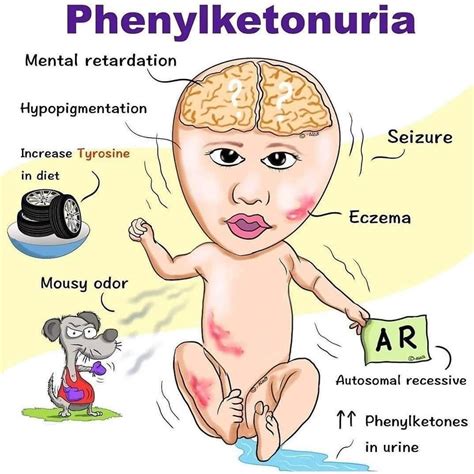 Fenilcetonuria (PKU) | Neurologie Pediatrica