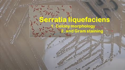 Serratia Gram Stain