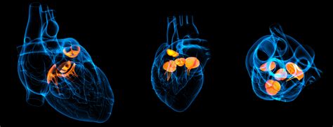 Staging and Prognosis of Heart Failure - BroadcastMed