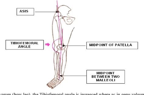 Figure 2 from A Study of Tibiofemoral angle among Healthy Male Maharashtrian population ...