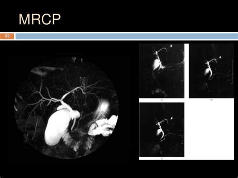 Mri contrast