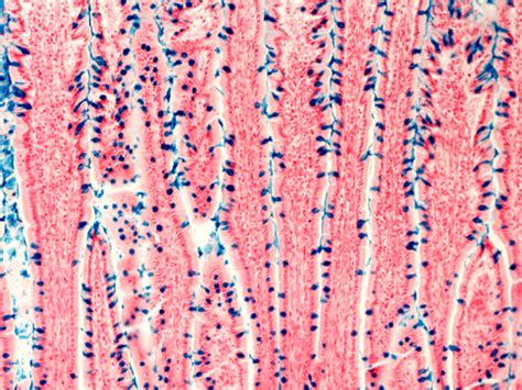 Researchers create functional intestinal organoids