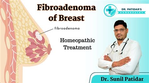 Fibroadenoma of Breast Homeopathic Treatment | Symptoms, Causes, Prevention | Dr. Sunil Patidar ...