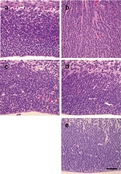 Histology of the telencephalon (a), diencephalon (b), mesencephalon... | Download Scientific Diagram