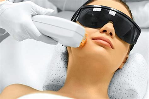 Photofacial - Dermatologist in Gurgaon