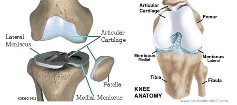 Tibial Plateau Fractures: Basic Anatomy, Mechanism, Treatment, and Complications