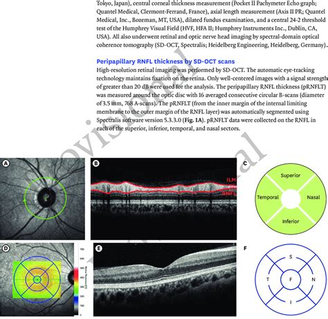 OCT scans of right eye of patient showing normal RNFL and mRT values in... | Download Scientific ...