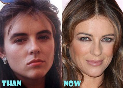 Elizabeth Hurley Plastic Surgery Before and After Photos - Lovely ...