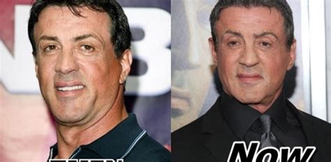 Sylvester Stallone Plastic Surgery Before and After Pictures Expendables