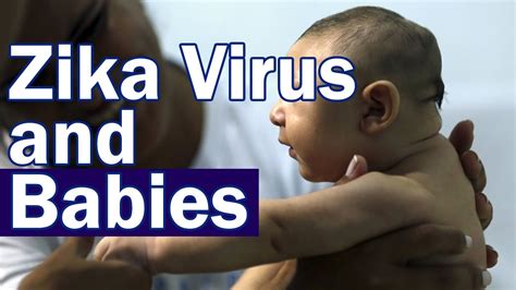 Zika Virus Babies - YouTube