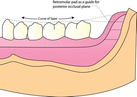 Retromolar Pad Anatomy