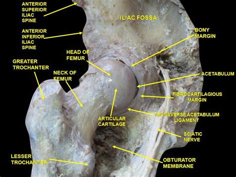 Neck of femur fracture pathophysiology - wikidoc