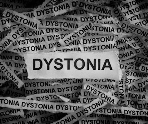 Dystonia: Symptoms, Causes and Treatment | by Kanemalachi | Medium