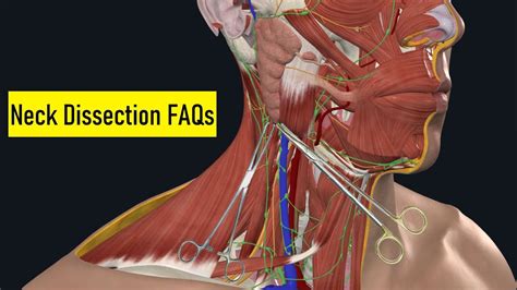 Neck Dissection Surgical Anatomy: OR FAQs & Answers [201] Didactic ...