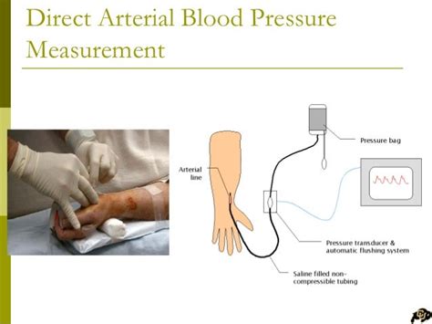 ANES 1502 - M9 PPT: Fundamentals of Critical Care