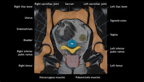 Pelvis Anatomy Module | CaseStacks.com