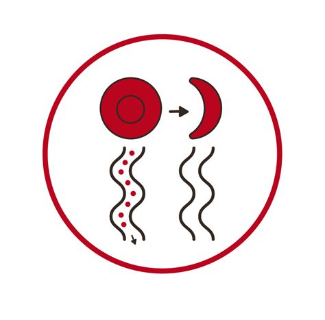 Haemoglobinopathies | Haematology Clinic