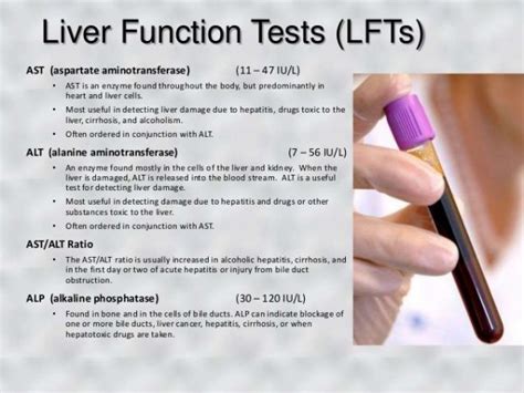 The meaning of Alanine Aminotransferase test in liver disease diagnosis - Abbkine – Antibodies ...