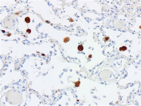 Cytomegalovirus (CMV) Histology Control Slides