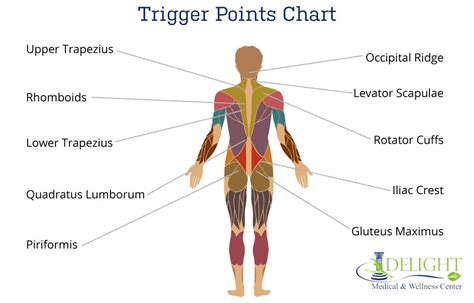 Trigger Points and Referral Pain - Delight Medical and Wellness Center