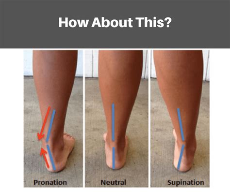 pronation and supination does not help us predict the right running shoe | PhysioWorks, Sports ...