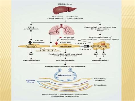 Hepatopulmonary syndrome