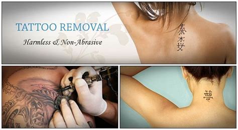 How to remove tattoos at home fast – 28 natural ways | Homemade tattoos, Tattoo removal, Hipster ...