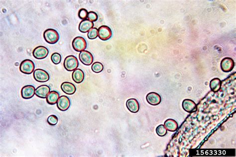 Rhizopus Oligosporus Microscope