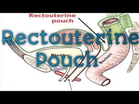 Rectouterine Pouch| Pouch Of Douglas| Abdominal| Anatomy - YouTube