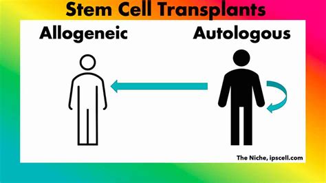 Autologous vs allogeneic: all you need to know on therapy - The Niche