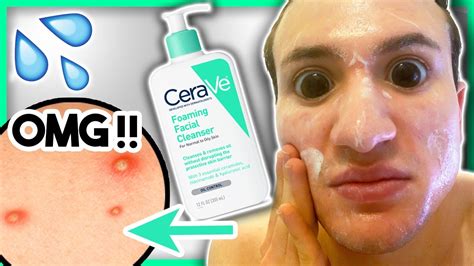 I used CeraVe Foaming Facial Cleanser for ONE WEEK!! (it broke me out ...