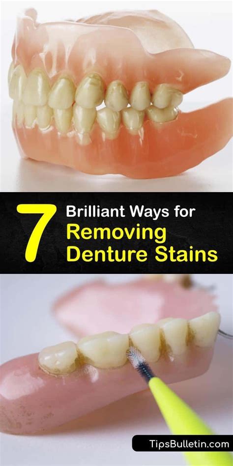 How To Remove Partial Dentures – T-TAPP