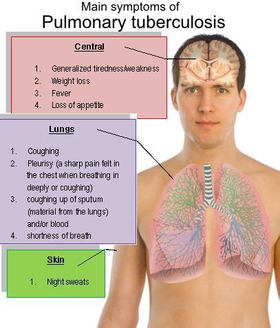 Tuberculosis: Symptoms and diagnosis of tuberculosis