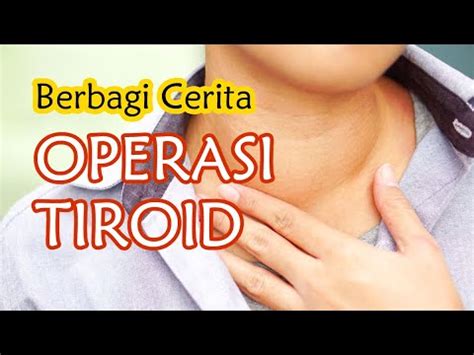 Operasi Kelenjar Tiroid - YouTube