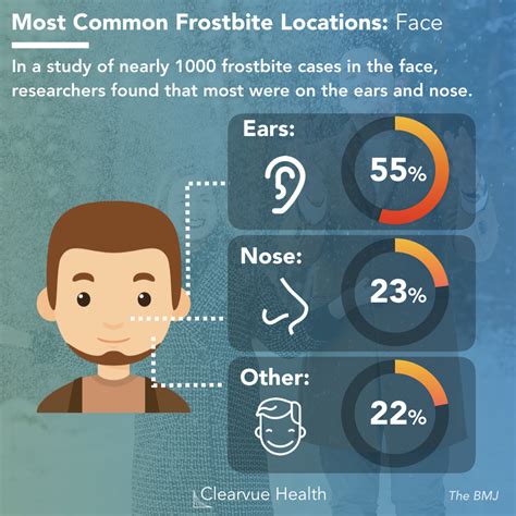 3 Charts | Frost Bite on Your Face: Statistics & Prevention